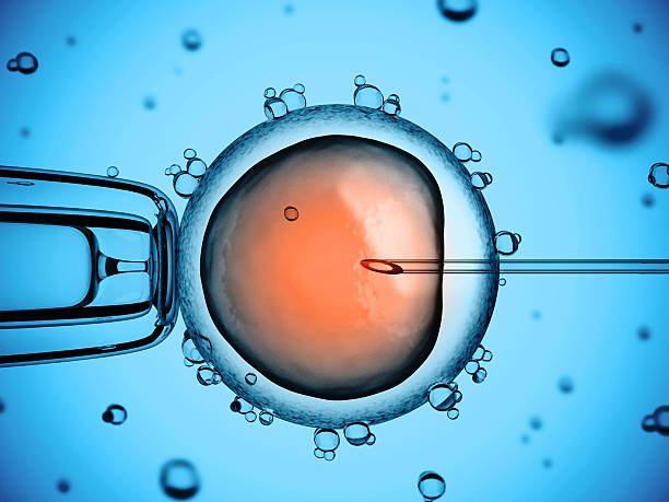 IVF Procedure