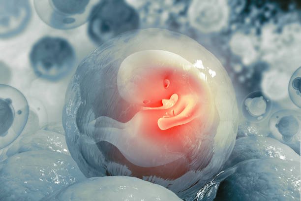 Frozen Embryo Transfer